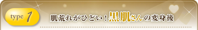 【シミが気になる黒肌さんの変身後】